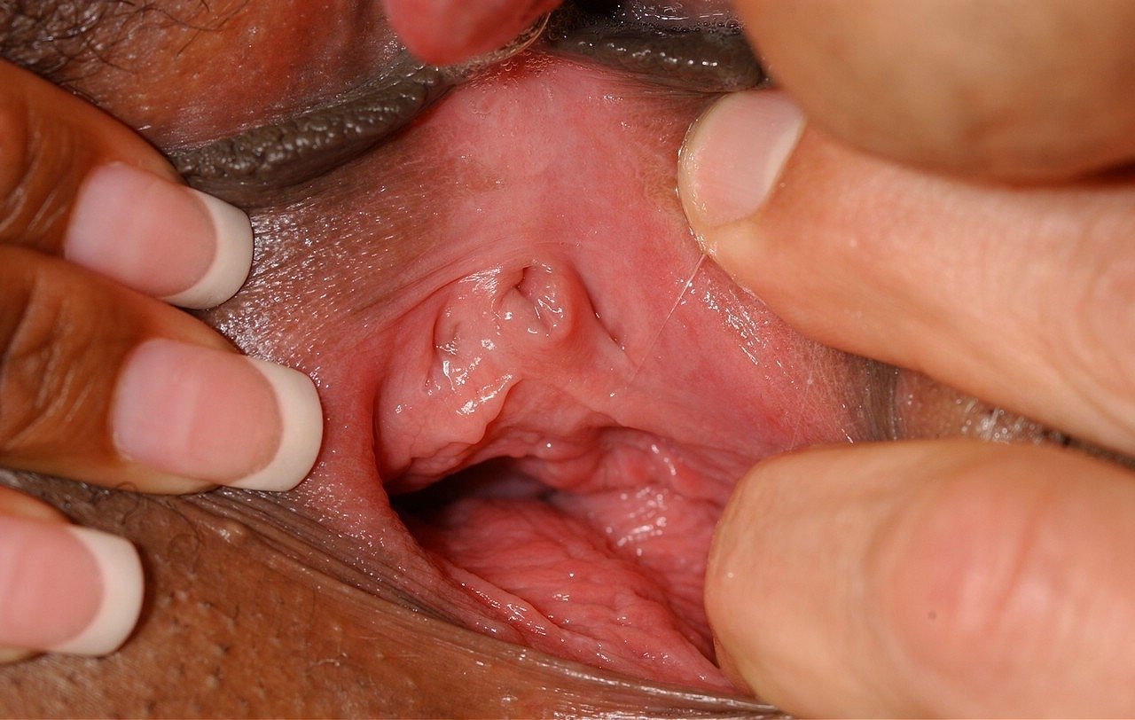 Female cervix view best adult free photo