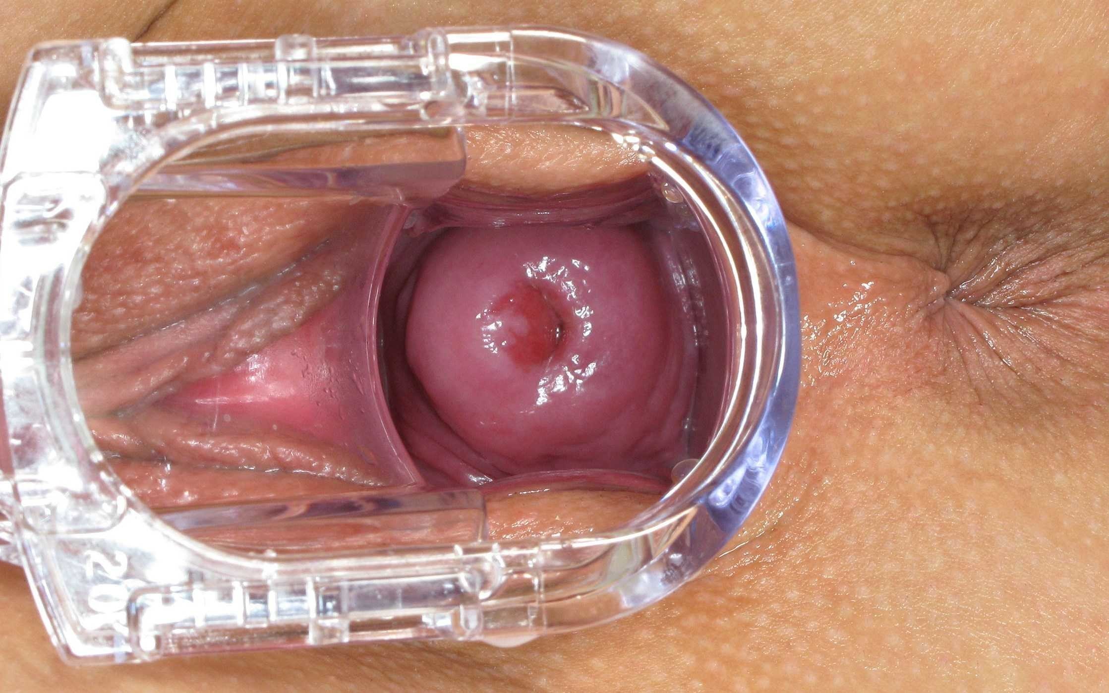Head inserted vagina