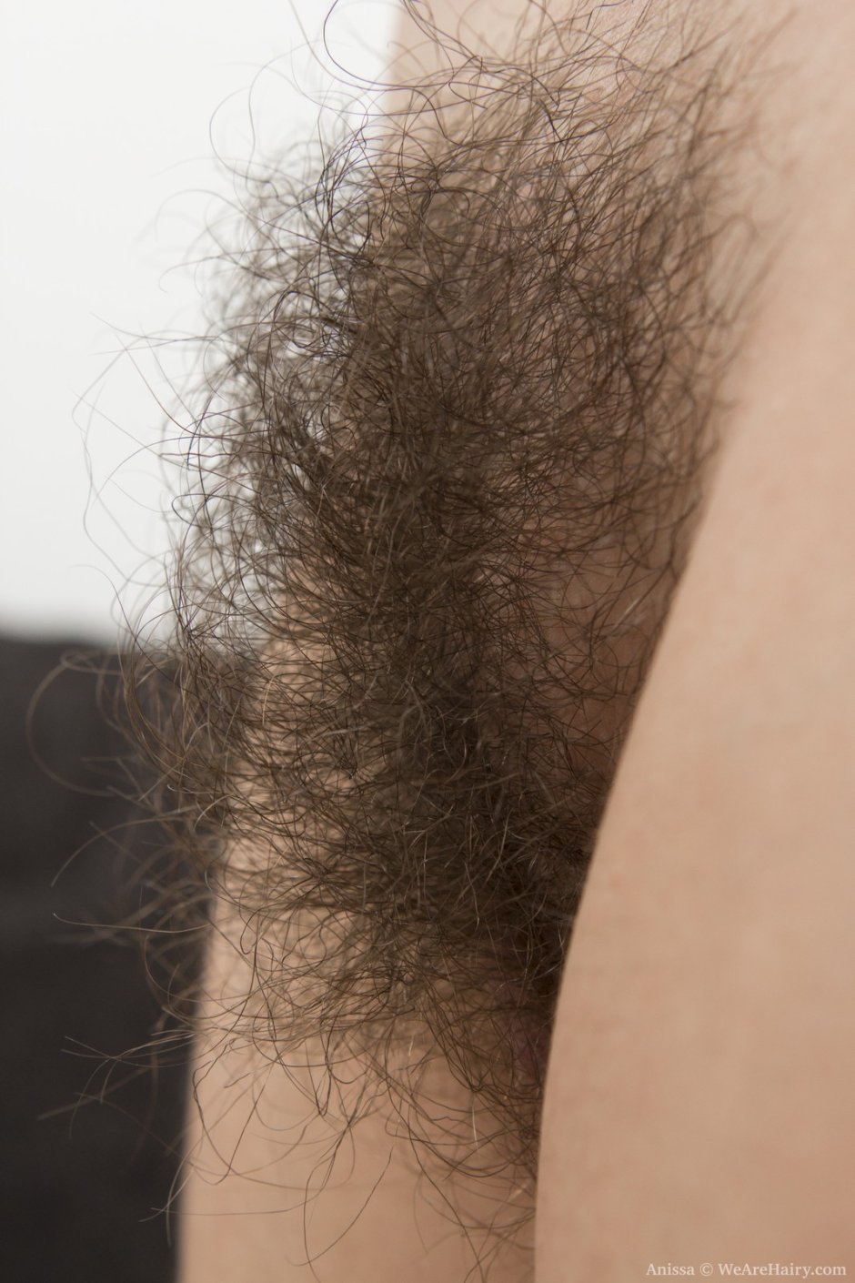 Very hairy female pubis
