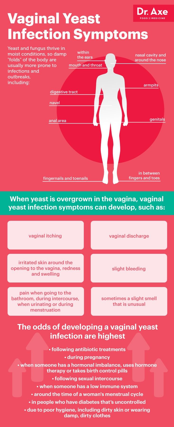 Vaginal Yeast Infection