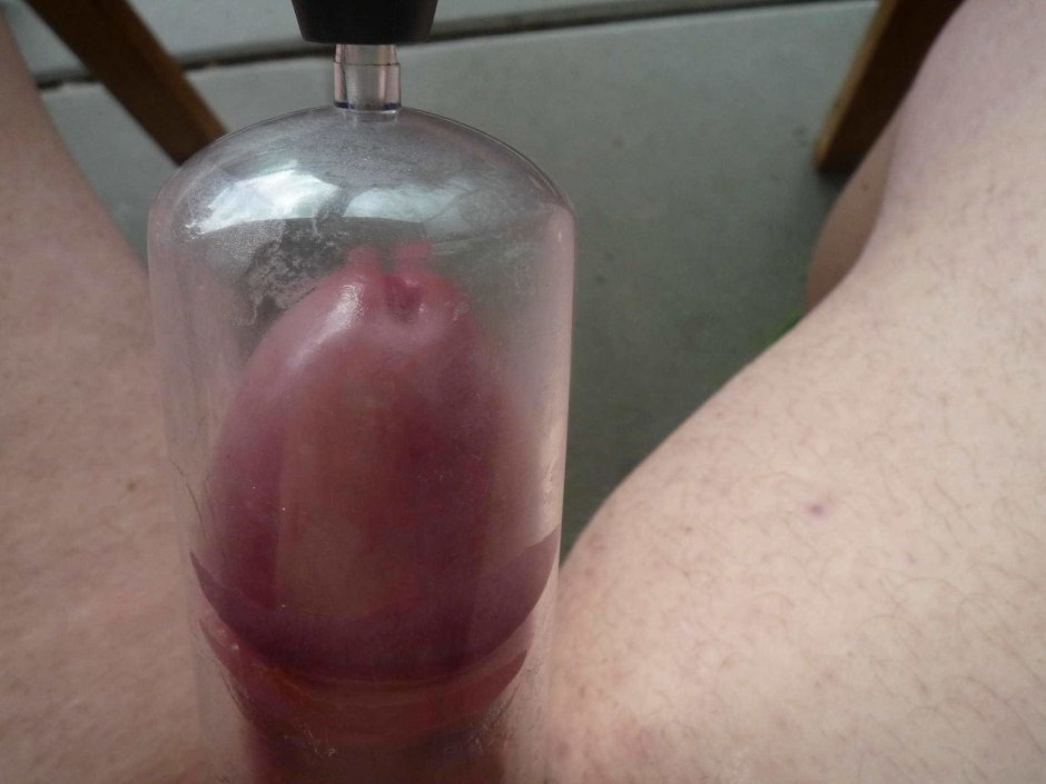 Vacuum pump for scrotum