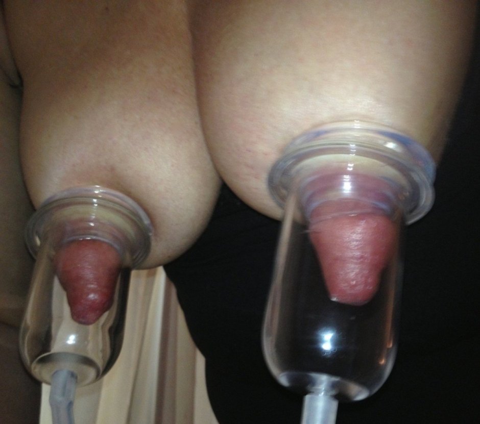 Clitoris after a vacuum pump