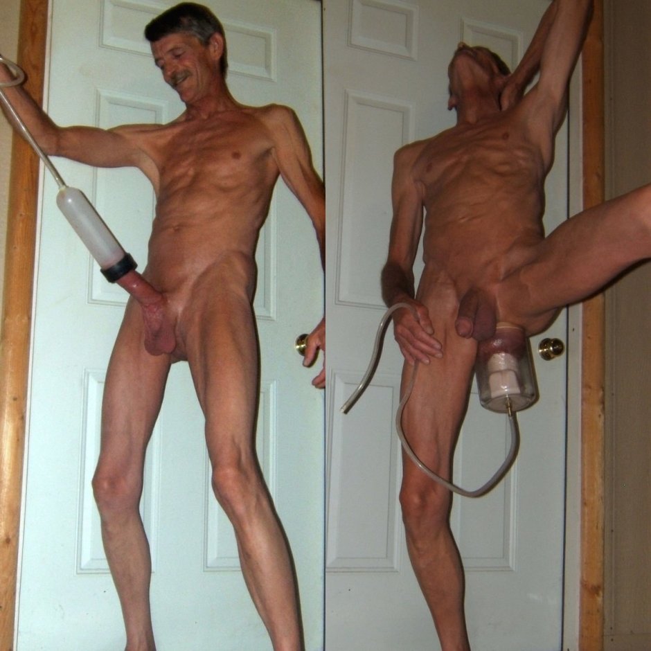 Vacuum penis enlarger before and after