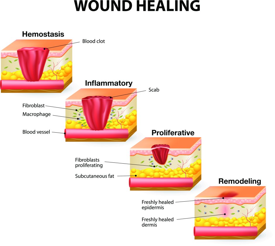 The healing process of wounds
