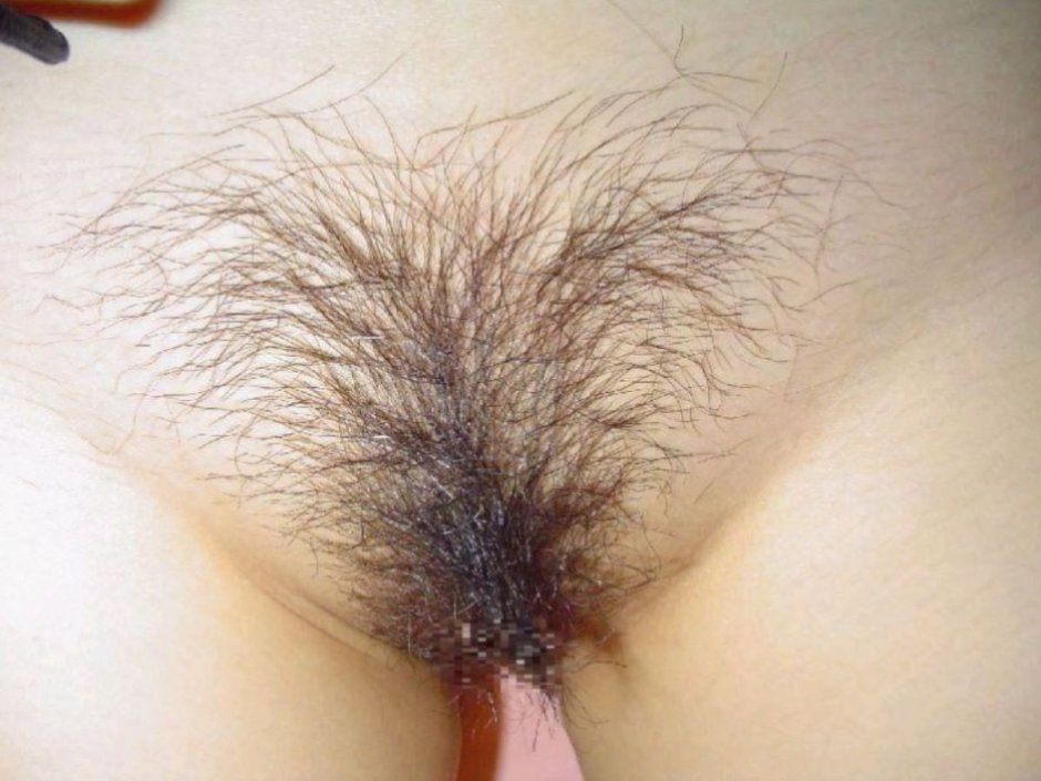 A strip of pubic hair in women