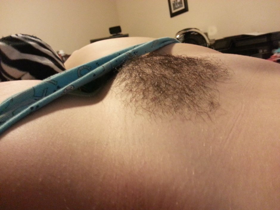 Beautiful convex pubis