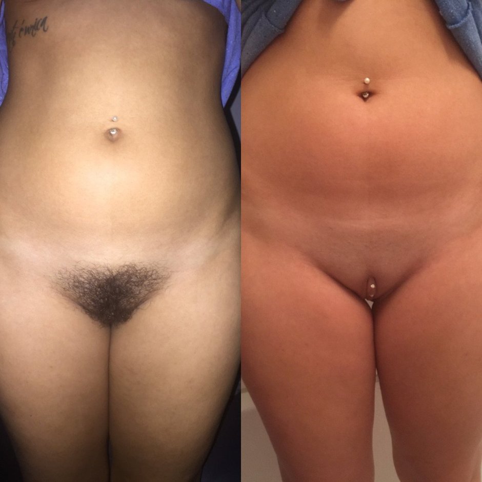 Short hair on the pubis
