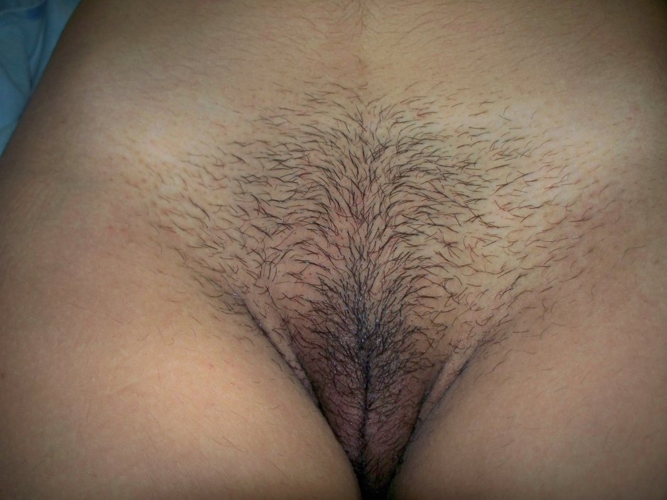Classification of female vagina