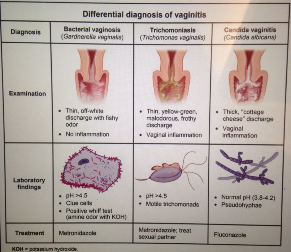 Monistat Vaginal Health Test