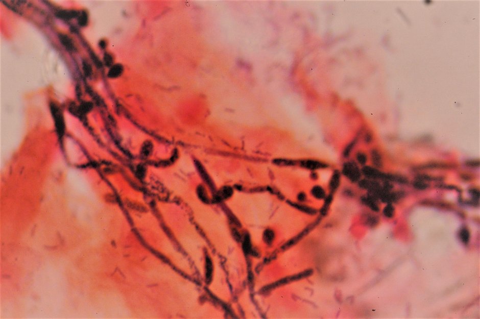 Nucleus bacterium