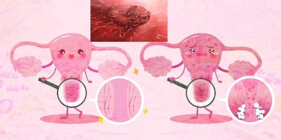 Https: //image.shuttestock. COM/Image-Photo/Study-Tapeworm-Infection-Caused-By-600W-1274695297