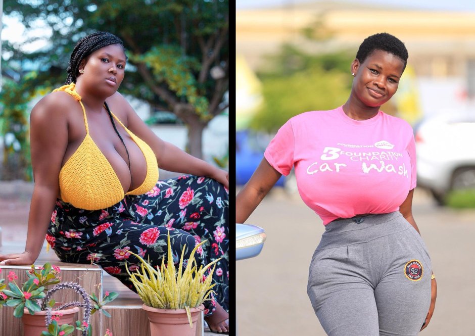 Pamela Odame Watara before surgery
