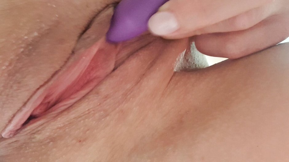 Large excited clitoris