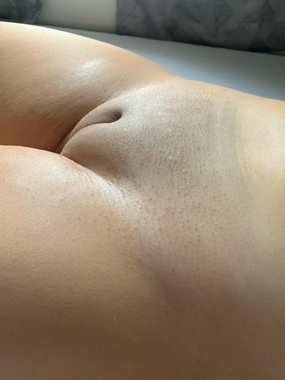 Venus mound in girls