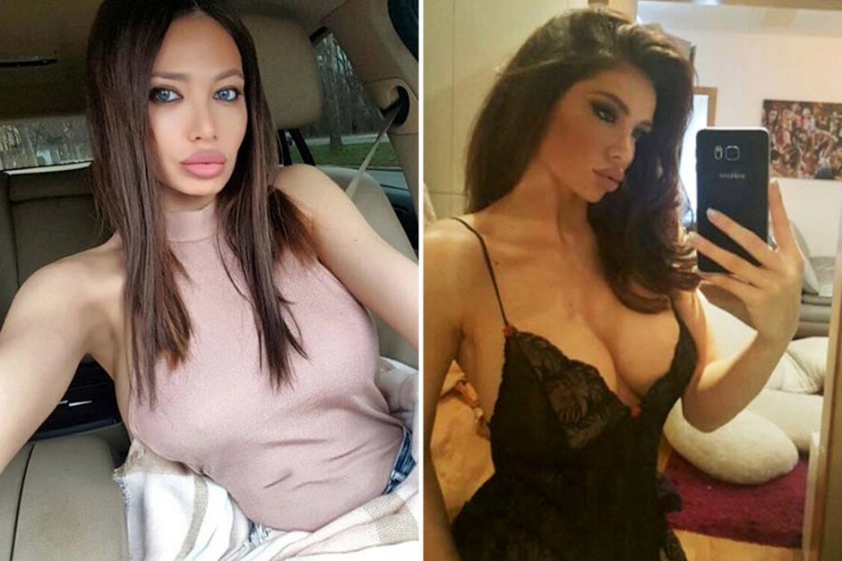 Sorai Vuchelich to plastic