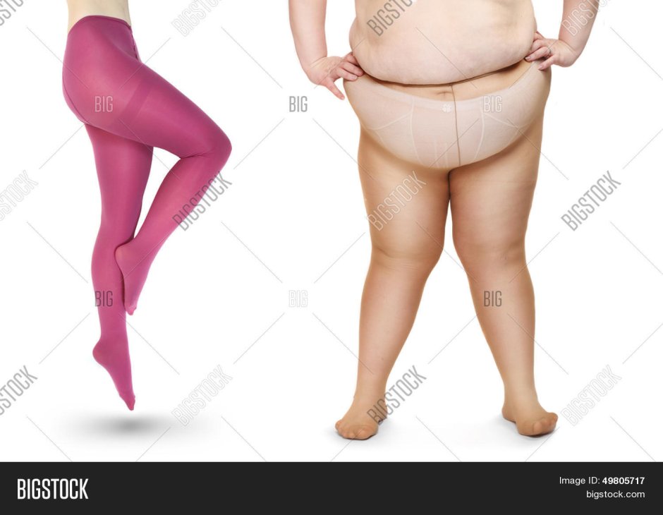 Thick -legs