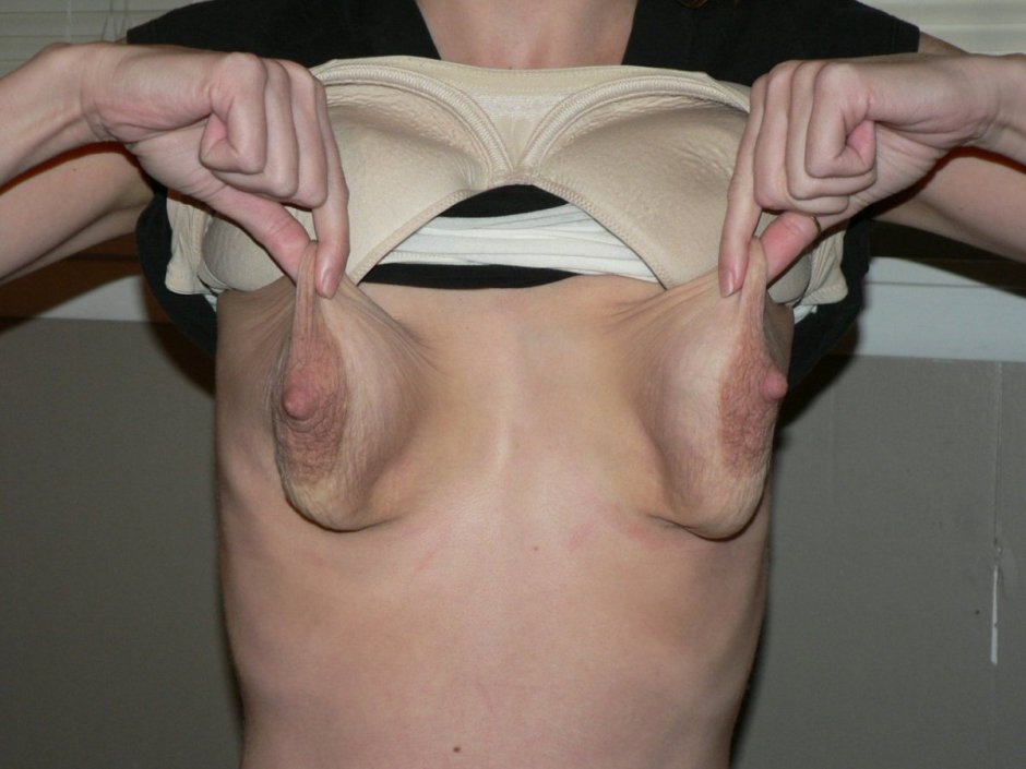 Mature huge saggy boobs