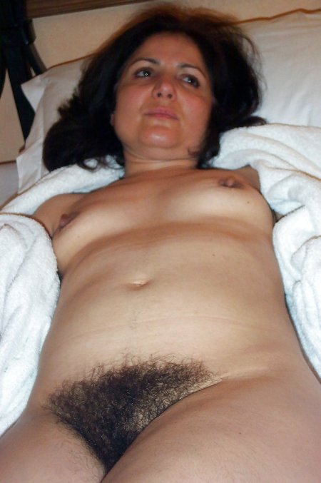 Older woman with hairy pubis