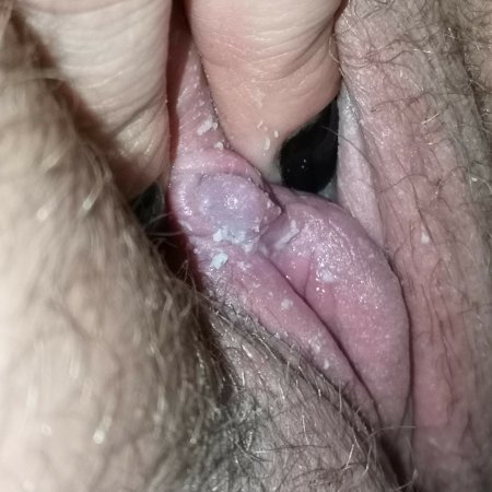 Hairy vagina smegma