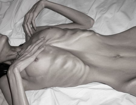 Beautiful naked Anorexic women