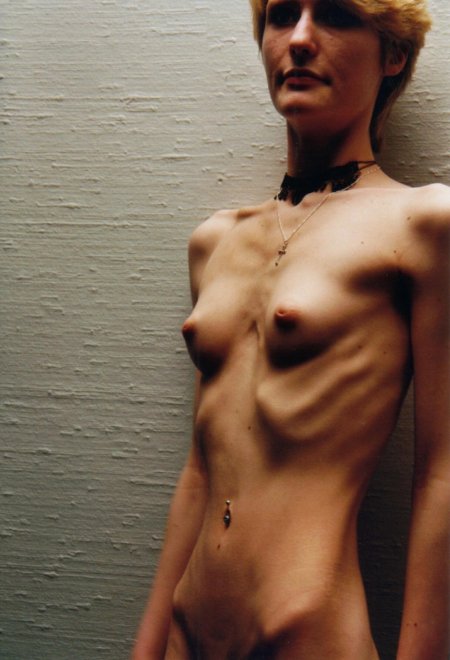 Naked Anorexic women photo