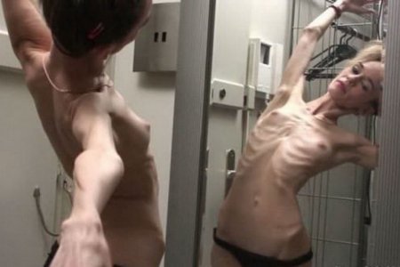 Naked guy with anorexic