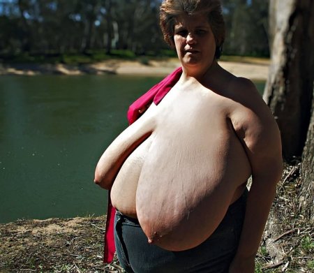 Huge saggy boobs