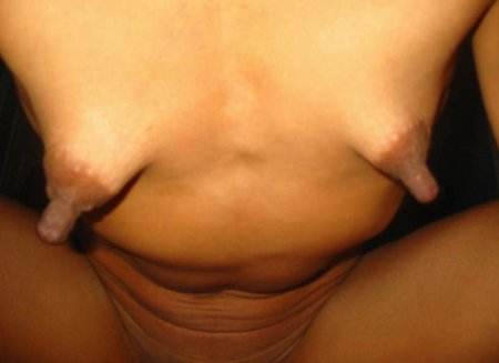 Female breasts with long nipples