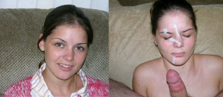 Pimply girls get facials