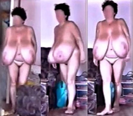 Heather Beck macromastia