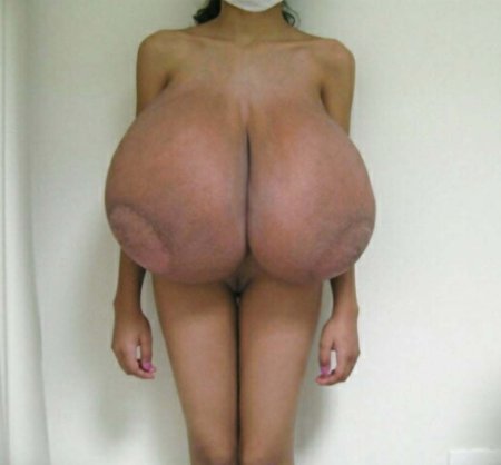 Ting Hiafen and Farang Ding Dong naked