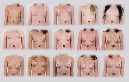 Women with different shapes of Boobs