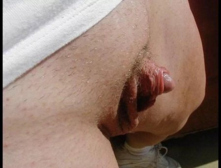 Huge clitoris sticking out
