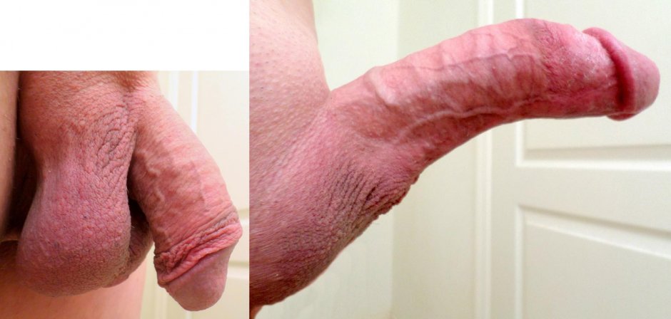 Penis before an erection