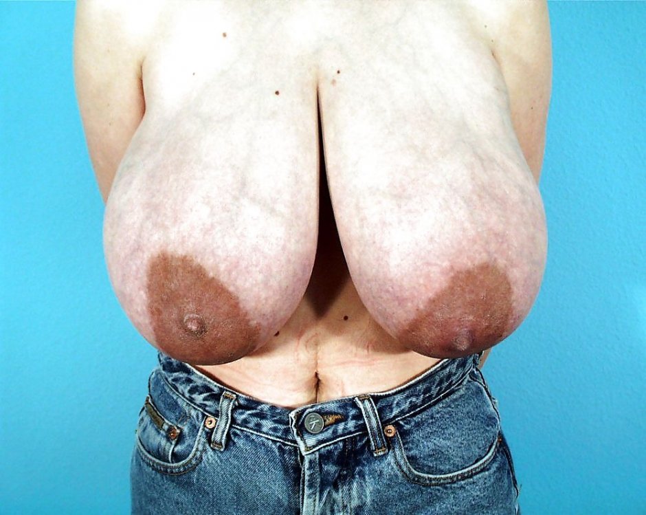 Imagefap Omg Big Boobs Macromastia Alena Barbara
