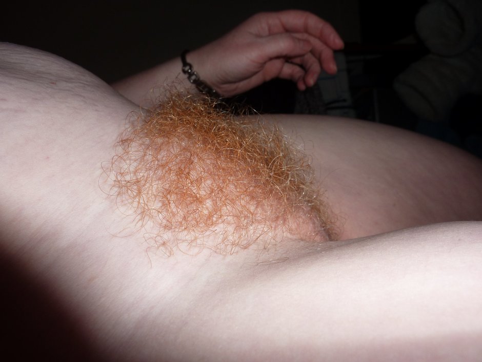 Fight vegetation on the pubis