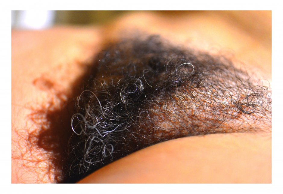 Long pubic hair