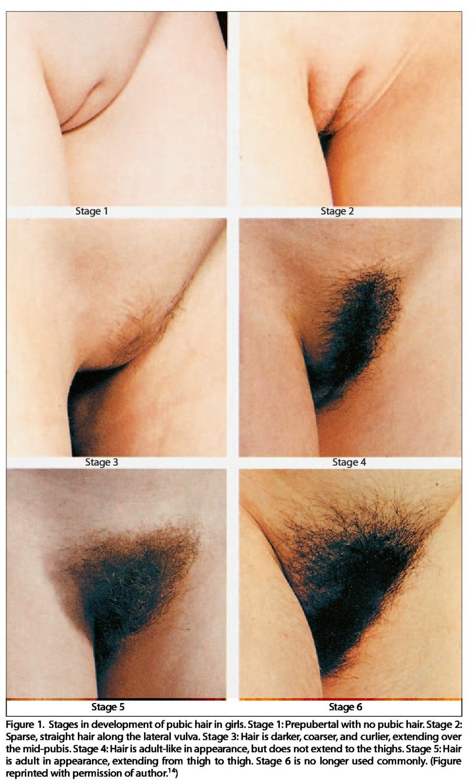 Early sexual growth