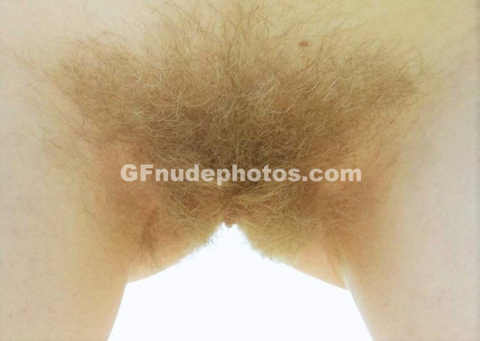 Light hair on the pubis