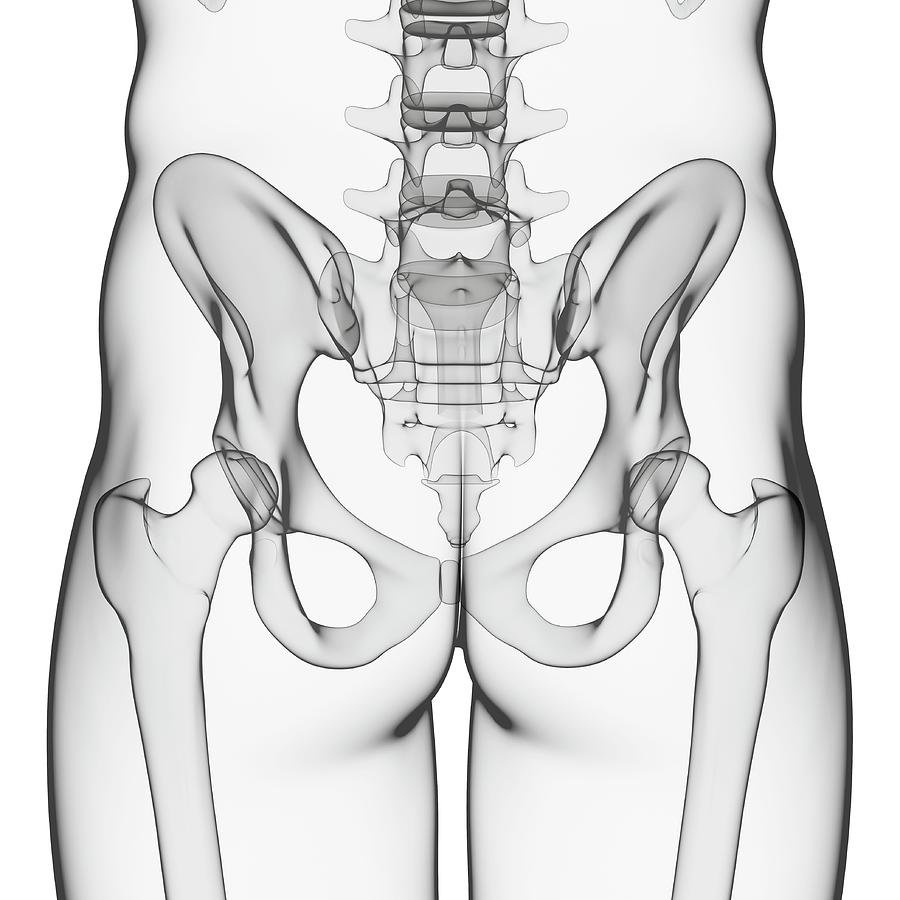 Small Pelvis