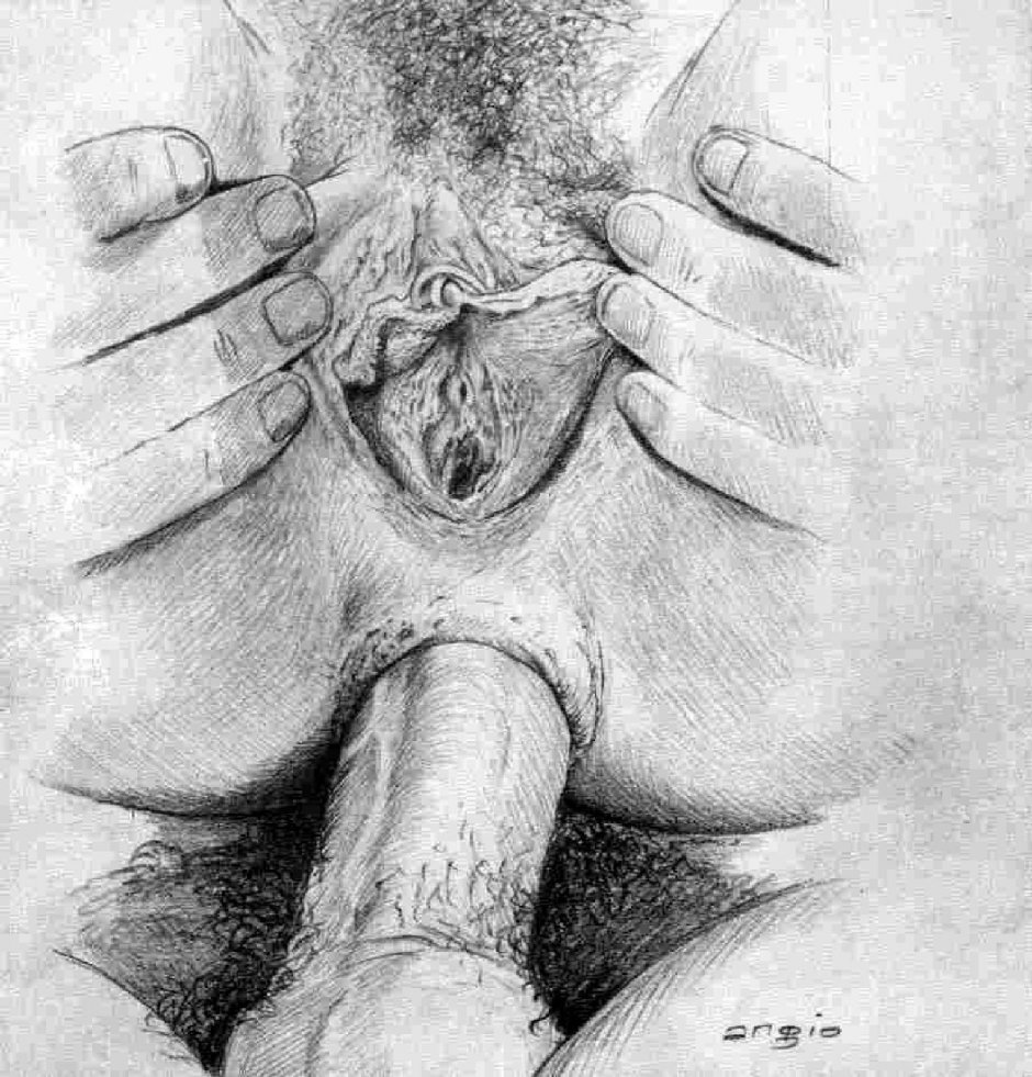 Crying with a pencil of vaginas