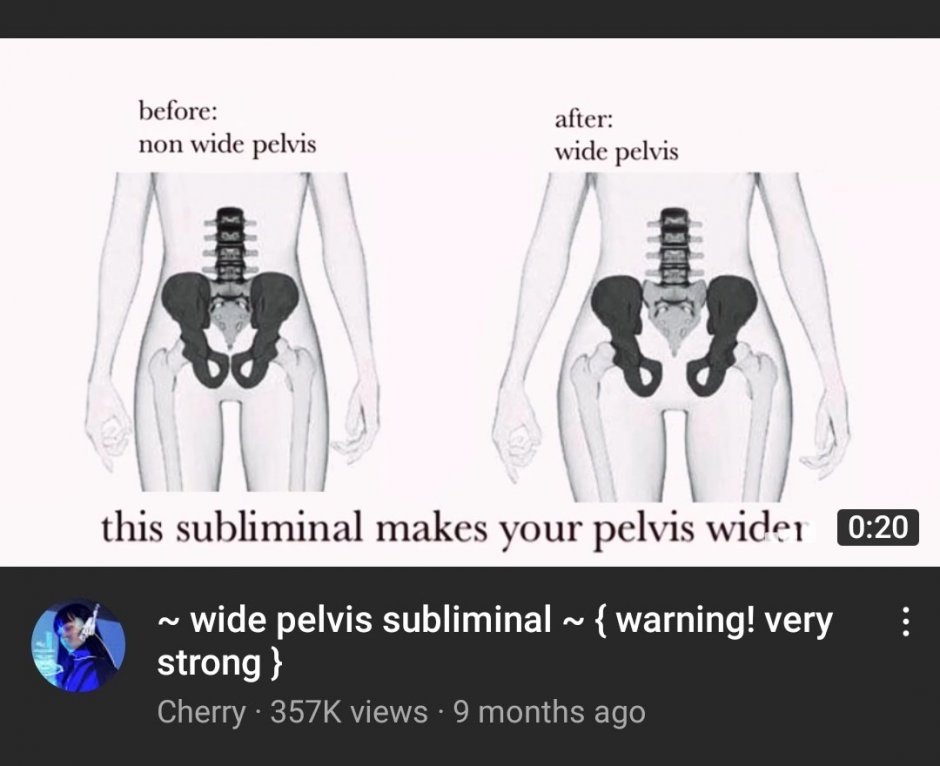 Female Pelvis