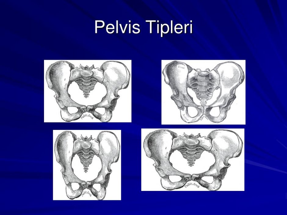 Posterior Pelvic Tilt