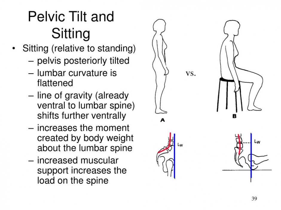 Narrow Pelvis