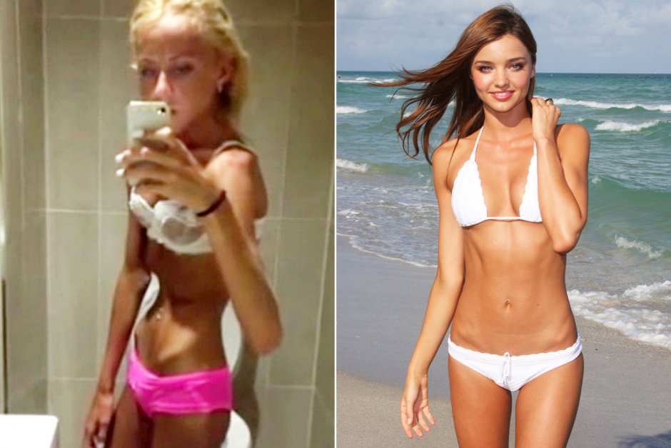 Selfie girls with anorexia