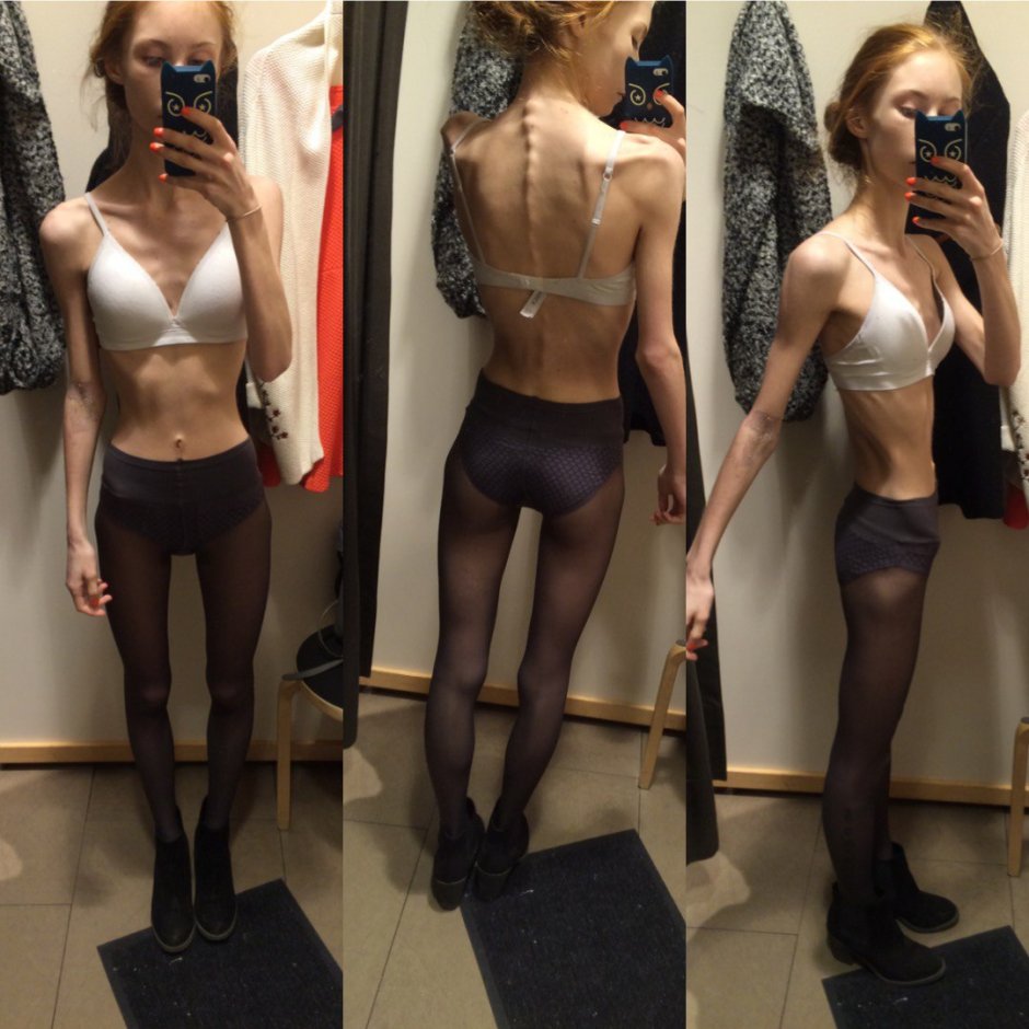 Thin girls before and after