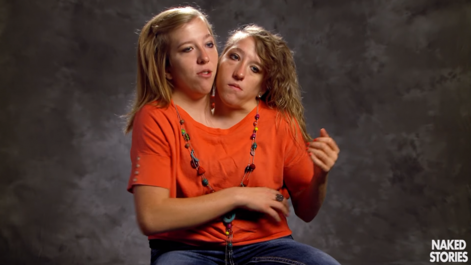 Abigail and Brittani Hensel 2022
