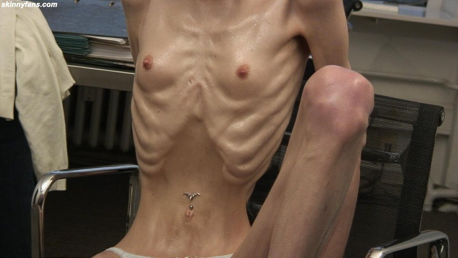Beautiful naked anorexics