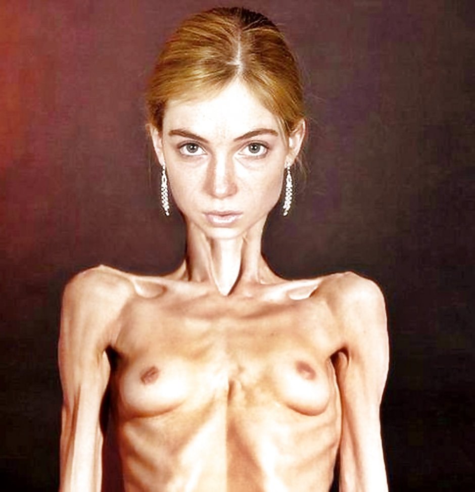 Very thin naked women