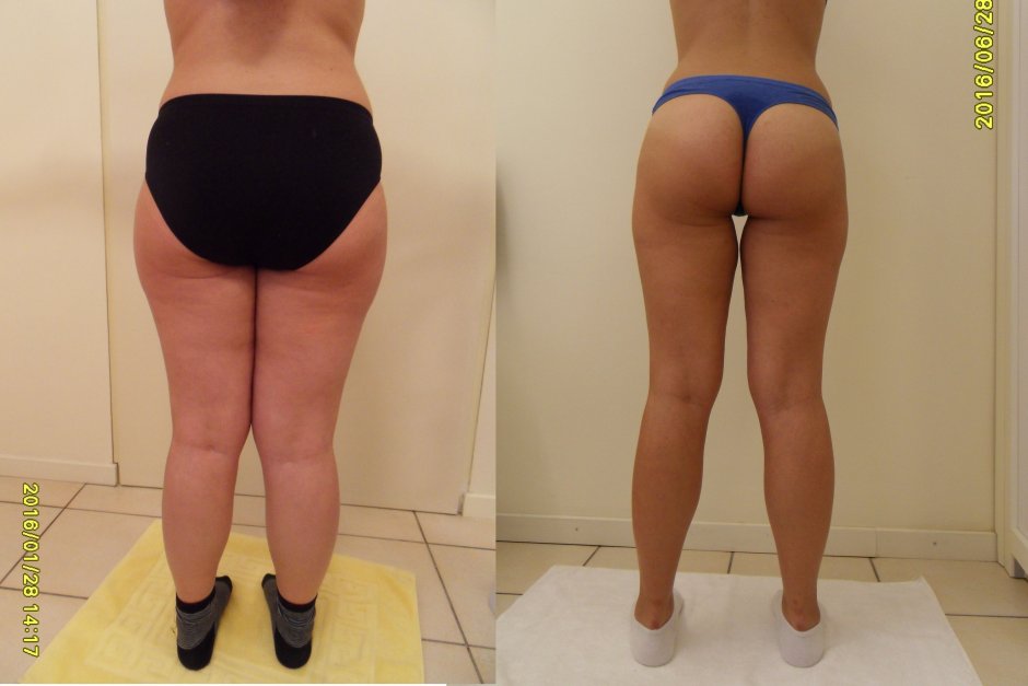 BBW Cellulite Belly on the street Naked Hairy